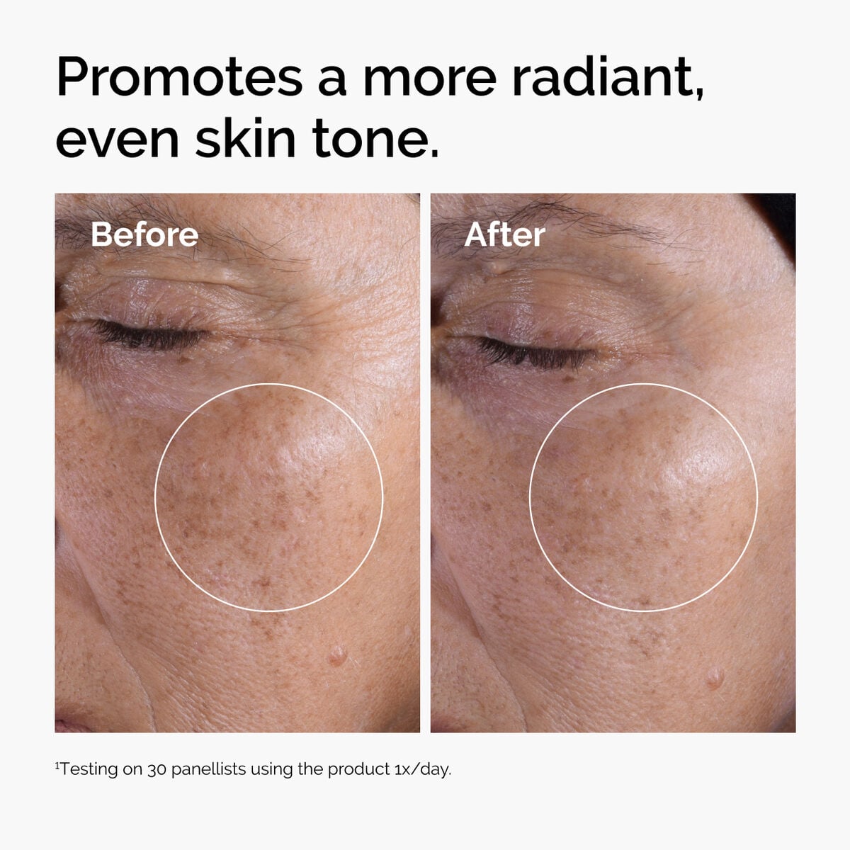 glycolic-acid-7-exfoliating-toner-l3 ord-glycolic-before-after-radiance.jpg